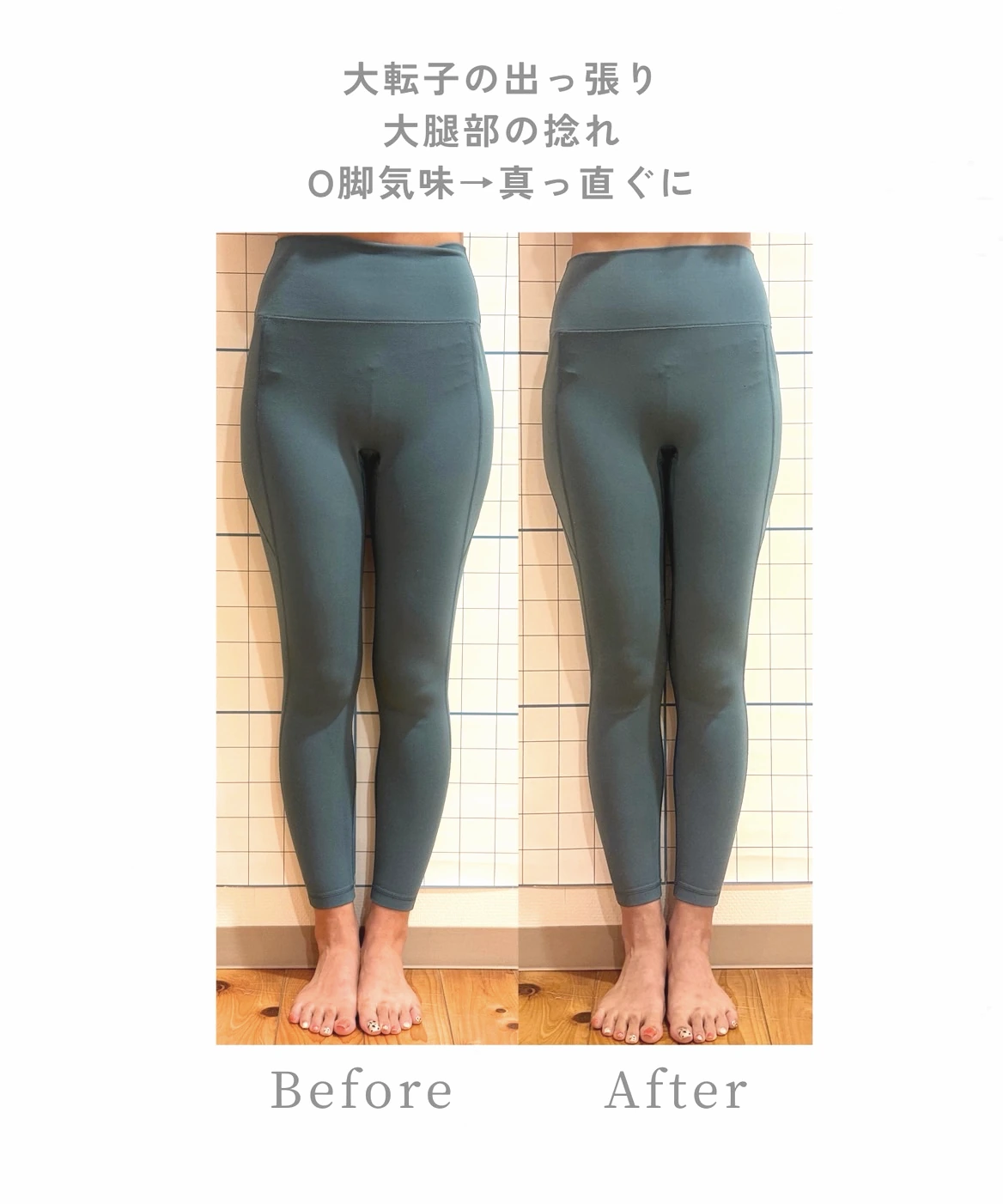 脚ラインの参考事例